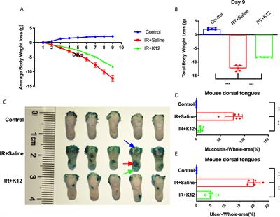 Probiotic Streptococcus salivarius K12 Alleviates Radiation-Induced Oral Mucositis in Mice